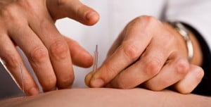 Acupuncture addiction treatment is introduced in Singapore 66 Acupuncture addiction treatment is introduced in Singapore